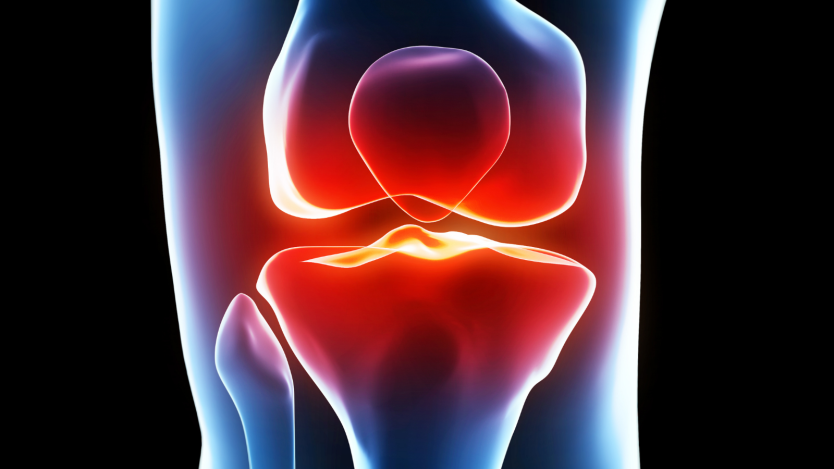 Knie-Totalendoprothese