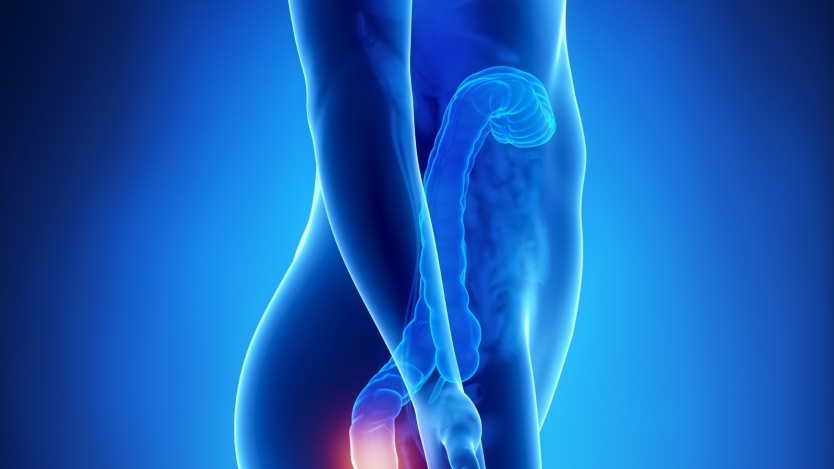 Anal Fissure Surgery