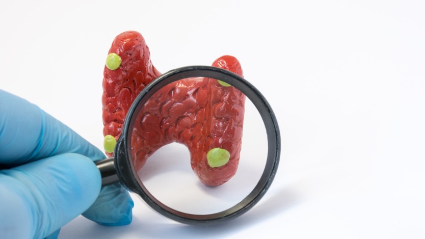Picture of a parathyroid gland