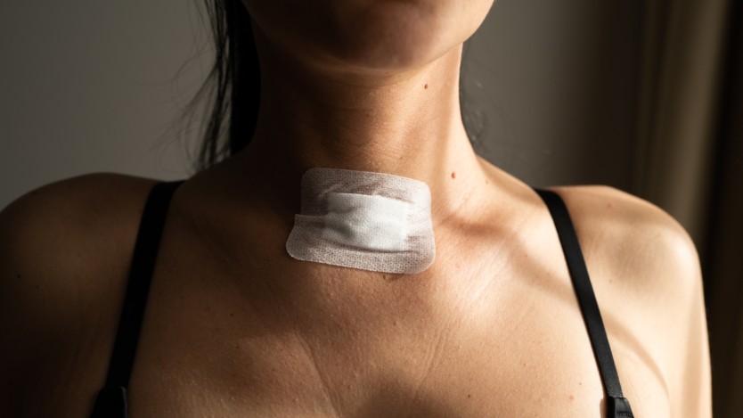 Patient with a bandage on the throat area after having parathyroid surgery